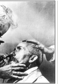 A-Gustav-Killian-the-father-of-bronchoscopy-performing-one-of-the-very-first